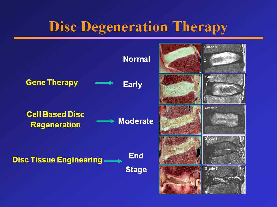 Research Disc Degeneration Therapy diagram