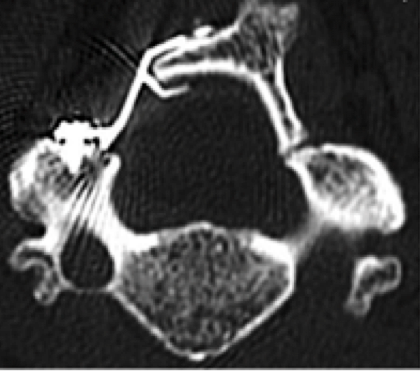 Screen Shot 2017 08 31 At 10.53.17 PM