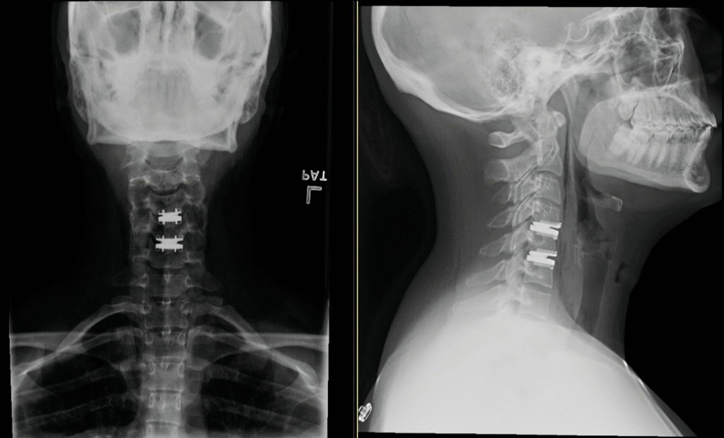 Screen Shot 2017 08 31 At 11.02.09 PM 1024x620